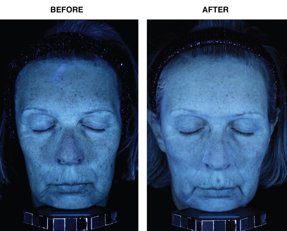 Skin Memory Serum — Deep Cellular Regeneration | IDEO Skincare