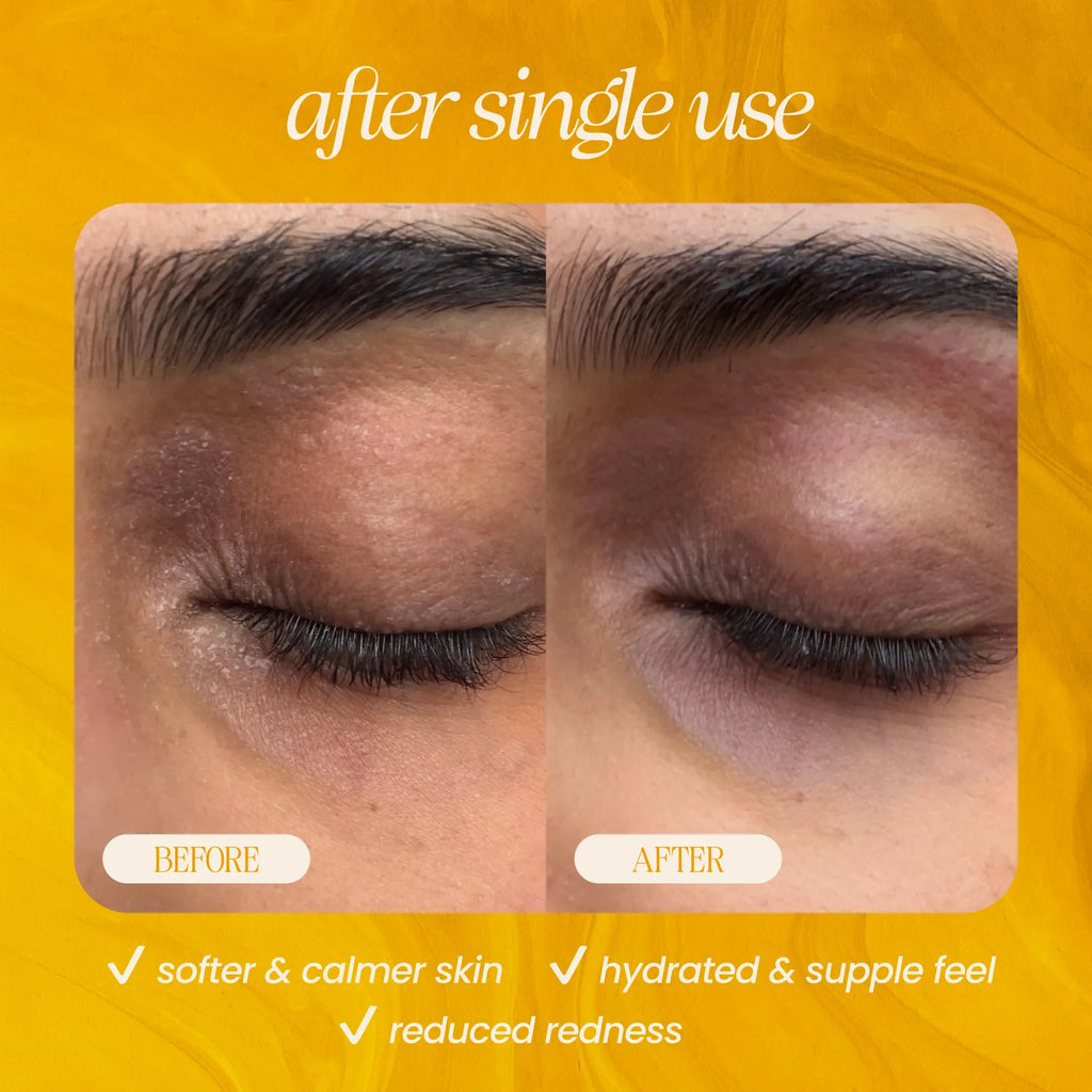 Blueberry & Papaya Glow Serum — Brightening & Antioxidant Boost